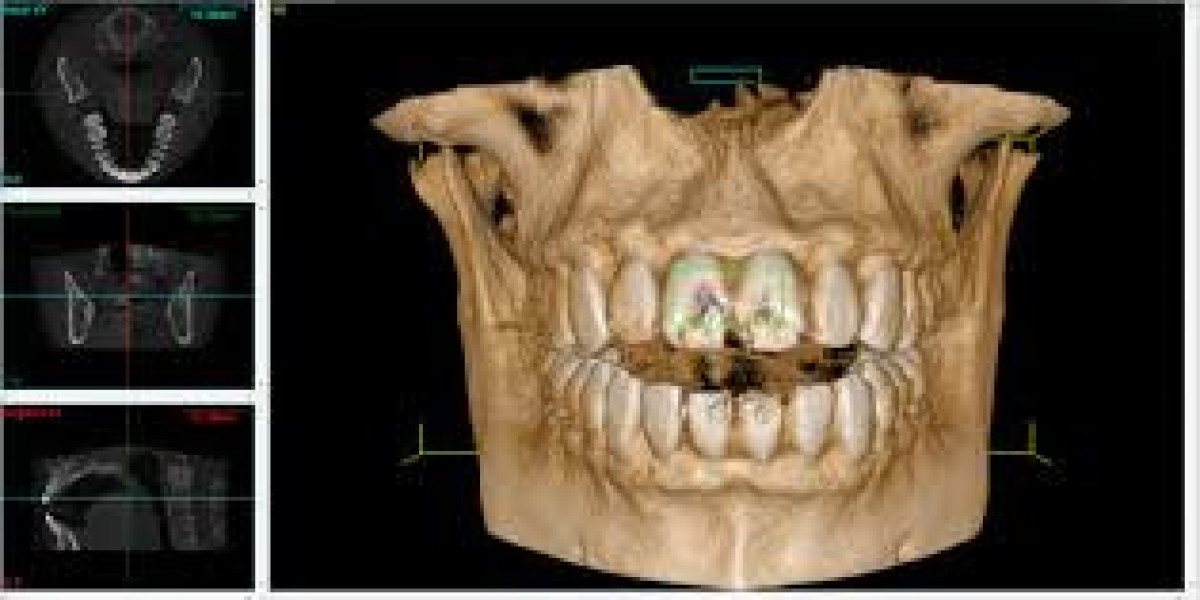 Global CBCT Dental Imaging Market Report 2024–2032: Key Players and Competitive Landscape